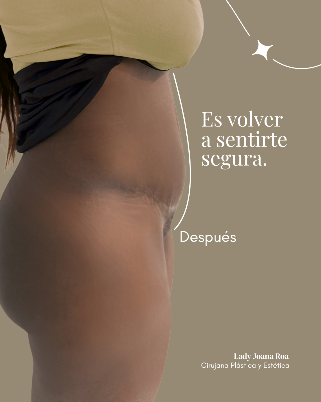 No-es-cambiar-tu-cuerpo-es-reencontrarte-con-tu-confianza---7.png
