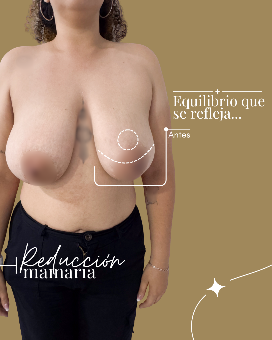 No-es-cambiar-tu-cuerpo-es-reencontrarte-con-tu-confianza---8.png