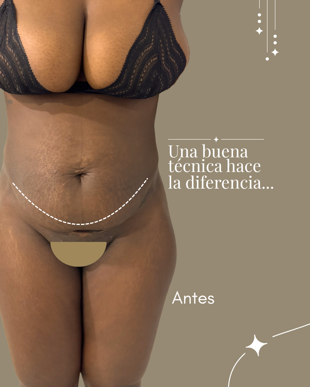 No-es-cambiar-tu-cuerpo-es-reencontrarte-con-tu-confianza---10.png