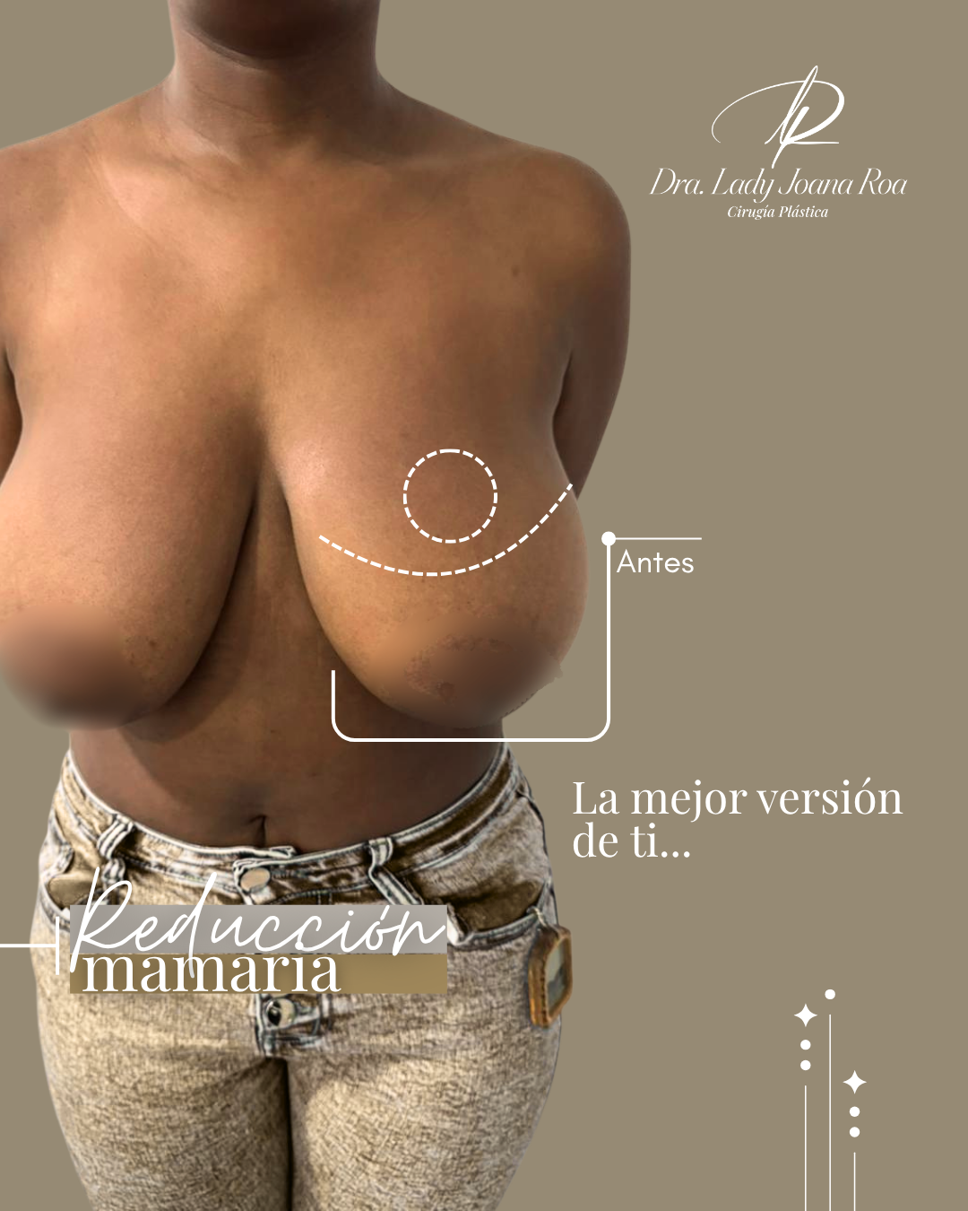No-es-cambiar-tu-cuerpo-es-reencontrarte-con-tu-confianza---13.png