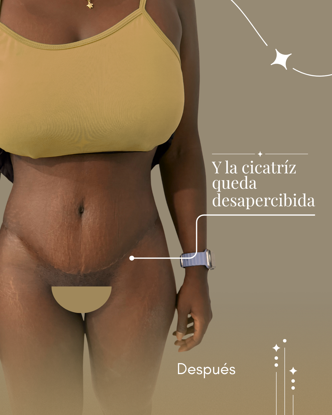 No-es-cambiar-tu-cuerpo-es-reencontrarte-con-tu-confianza---11.png